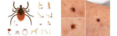 Once you have removed the tick, wash the wound site and your hands with soap and water, and apply rubbing alcohol or antiseptic to the site. What To Do When You Have A Tick Bite Bmh Medical Group