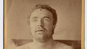 Northfield Bank Raid of 1876