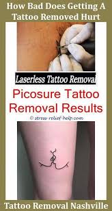 The dye in the henna, a. Pin Auf Tattoo Removal