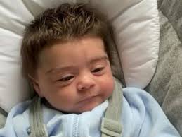 Premature baby with thick hair| Premature baby born with thick brown hair,  photo goes viral