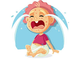 Vaksine mot meslinger ble innført i det nasjonale vaksineprogrammet til småbarn i norge i 1969. Meslinger Visker Ut Immunsystemet Sin Evne Til A Gjenkjenne Andre Virus Og Bakterier Vaksinebloggen