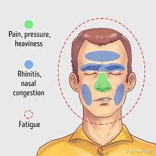 5 Types Of Headaches And The Best Ways To Get Rid Of Them Headache What Causes Headaches Sinus Headache Symptoms