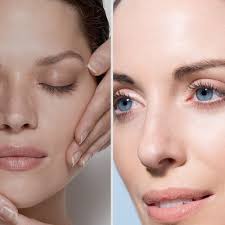 THE BEST 10 HAIR LOSS CENTERS near SAINTE-ROSE, LAVAL, QC, CANADA