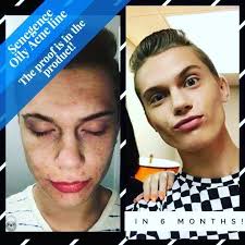 where can I buy shelly x products?