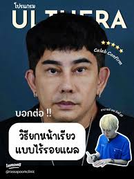 รีวิวโปรแกรม ULTHERA SPT ยกกระชับใบหน้าสำหรับคนวัย 30+