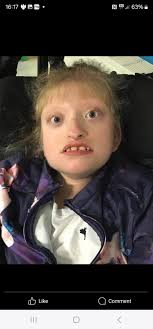 Tiktok star dies from stage 4 cancer