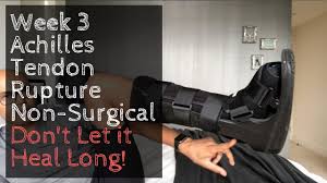 Bit.ly/ptmsk in the intermediate rehab phase after achilles tendon rupture repair you can. Week 3 Achilles Tendon Rupture Non Surgical Don T Let It Heal Long Youtube