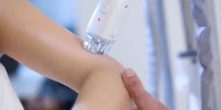 There shouldn't be any dirt on the surface. Laser Hair Removal Blue Velvet Staten Island Ny Skin Care Facials Laser Hair Removal Microneedling Waxing