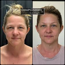 Complexions Beauty Lab