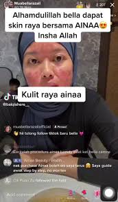 Dengarlah tip dari bella,kalau nak skin cantik dan sihat yew…. -Ras  Usahawan ainaa beauty- Berminat nak skin cantik boleh tekan link dibawah 📲  http://linktr.ee/etika90 🚗COD setiap hari 📮Postage ke ...