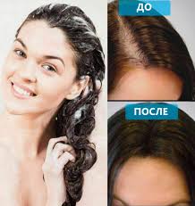 We did not find results for: Syampu Untuk Keguguran Rambut Di Farmasi Untuk Wanita Dan Lelaki Ubat Yang Paling Berkesan Dengan Zink Plasenta Vitamin Kafein Lada Penarafan