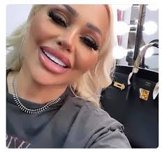 WTAF has Darcy done to her face? She looks like a cartoon character