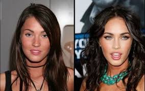 Megan fox before and after plastic surgery (photo). 13 Time When Plastic Surgery Did Wonders Even Their Moms Denied To Recognize Them Steemit