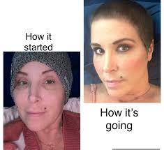 It's been 3 months since my last chemo.