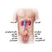 انواع بیماری های اورولوژی | دکتر حسن نیرومند جراح و فوق تخصص اورولوژی،  اوروانکولوژی و سرطان پروستات