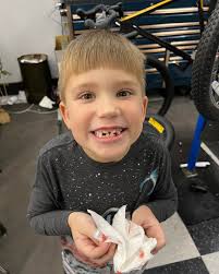 While it isn't his first tooth he's...