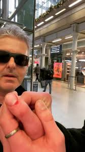 injured during boogie woogie jam😎