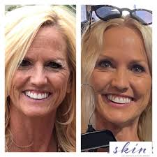 SKIN at the Institute of Facial Surgery