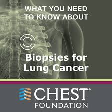 If a lung cancer tumor is blocking a major airway, it could cause shortness of breath. Lung Cancer Lung Health A Z Chest Foundation