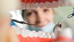 What to Expect During a Routine Dental Exam and Cleaning - Precision Smiles  Hackensack New Jersey