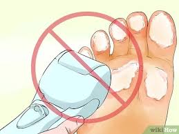 Do soak feet in epsom salts and warm water after dancing. 3 Ways To Prevent Calluses On Hands Wikihow
