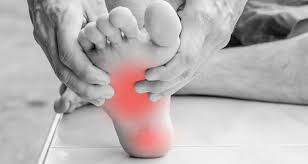 Plantar fibromatosis is a foot condition where a small nodule, a fibroma, grows in the arch of the foot on the plantar fascia. Midfoot Pain Symptoms Causes Treatment And Rehabilitation