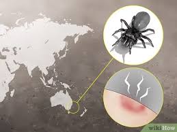By recognizing spider bites and reading a little advice, you can be way ahead in the event you get bit. 3 Ways To Treat Spider Bites Wikihow