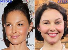Ashley judd news, gossip, photos of ashley judd, biography, ashley judd boyfriend list 2016. Ashley Judd Plastische Chirurgie Vor Und Nach Dem Foto