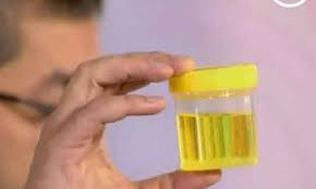 Bangunan yg dihiasi bendera ~; Warna Air Kencing Semasa Kehamilan 28 Foto Kenapa Gelap Pada Awal Dan Lewat Adakah Ia Berubah Dan Apa Yang Harus Menjadi Warna