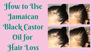 It is thus extremely beneficial in cases of temporary hair loss, making your hair shinier and stronger. How To Use Jamaican Black Castor Oil For Hair Loss Oil For Hair Loss Castor Oil Hair Loss Jamaican Black Castor Oil