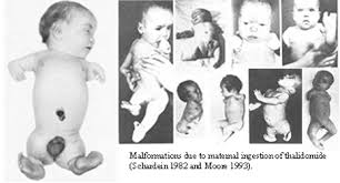 | 1957 kommt ein schlafmittel auf den markt, das viele menschen begeistert und das die werbung als nicht nur in deutschland. Thalidomide Scandal Wikipedia