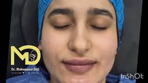 العيادة الأذنية التجميلية د. محمد دالي