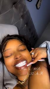 Here's your sign to do it ! I went from BRACES to VENEERS🥰 #fyp  #explorepage