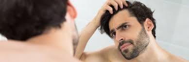 In questa patologia la perdita dei capelli è localizzata alle aree in cui i. Finasteride I Rischi Del Farmaco Contro La Caduta Dei Capelli Starbene