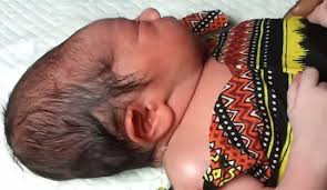 Image result for Vacuum Caput