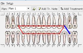 Orthodontic Charting In Dom Brs Dental Office Management