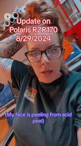 How to Remove The Roof of Rzr 170