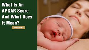 Image result for APGAR Score