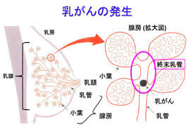 「乳がん」の画像検索結果