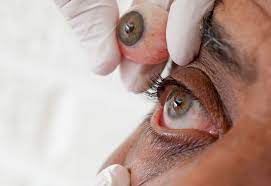 Artificial Eye Discomfort Southeastern Ocularists Inc