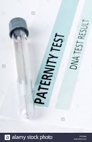 buccal swab in test tube on paternity dna test result chart