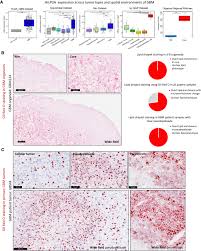 Yo maps mary you x d : Altered Lipid Metabolism Marks Glioblastoma Stem And Non Stem Cells In Separate Tumor Niches Acta Neuropathologica Communications Full Text