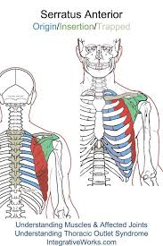 Pin On Pain