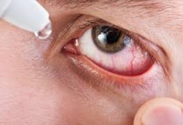 Comment Retirer Un Verre De Contact Brise Trucs Pratiques