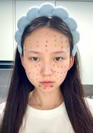 Dorothy Skin Booster