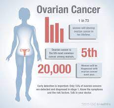 Every year, 7,000 women are diagnosed with ovarian cancer and 4,300 women lose their lives to it. How To Detect Ovarian Cancer Public Health