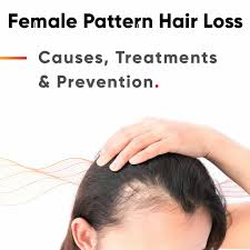 This article attempts to discuss several causes of hair thinning in women, preventive measures, and the recommended treatments available. Female Pattern Baldness An In Depth Look At Androgenetic Alopecia In Women Revian Red All Led Red Light Therapy For Hair Loss 10 Minutes Per Day Revian Red All Led