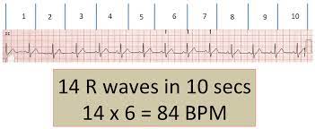 We did not find results for: Ecg Basics Rebel Em Emergency Medicine Blog