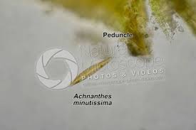 Image result for Entada bacillaris