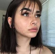 Pin By Serena Ramirez On Youth Girl With Acne Girl Short Hair Aesthetic Hair